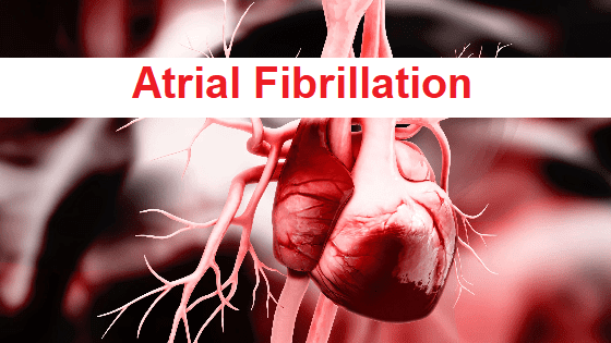 Read more about the article Atrial Fibrillation
