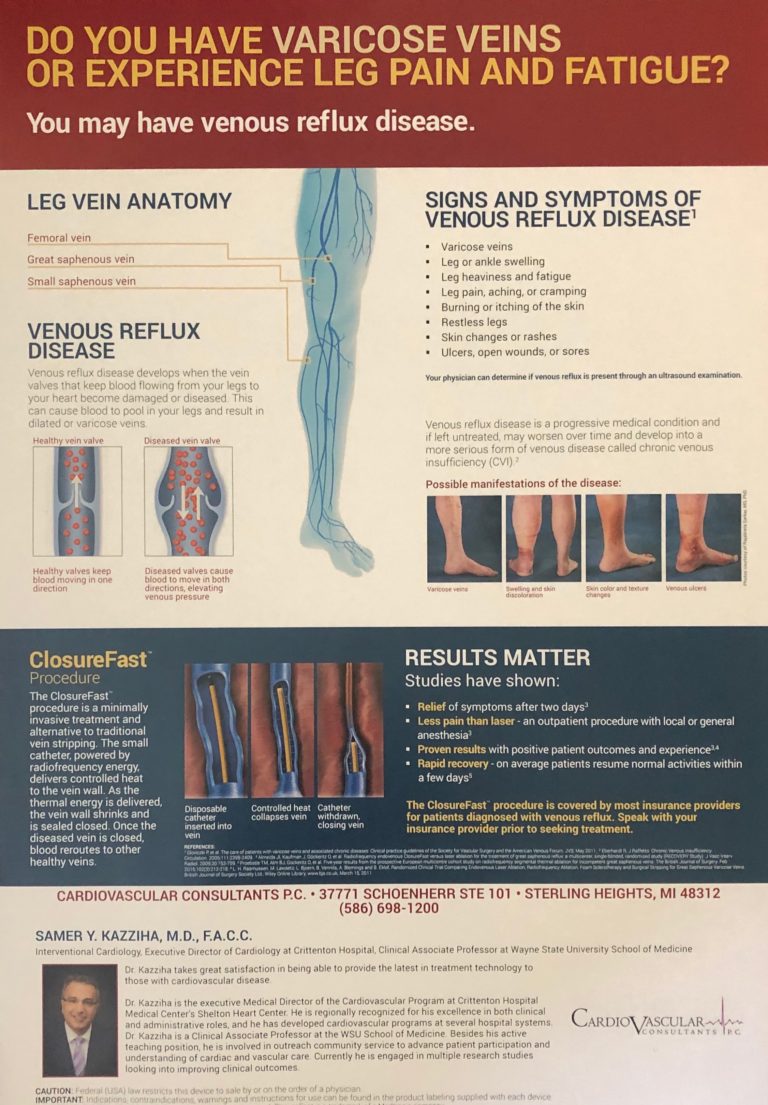 Varicose Veins